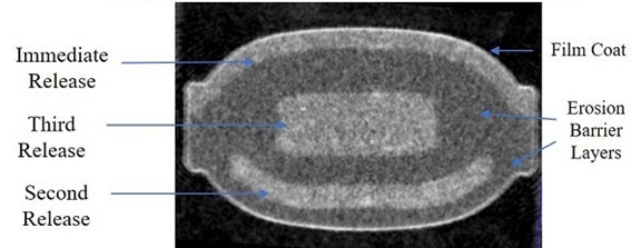 An x-ray of an egg

Description automatically generated